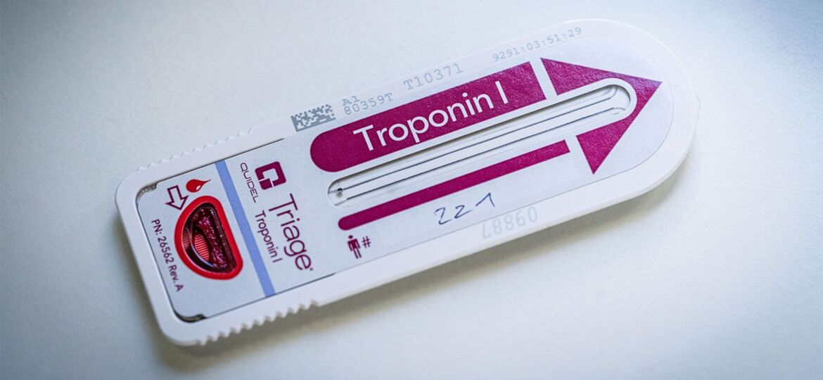 Troponin Could Play Larger Role Predicting Risk in Stable CAD