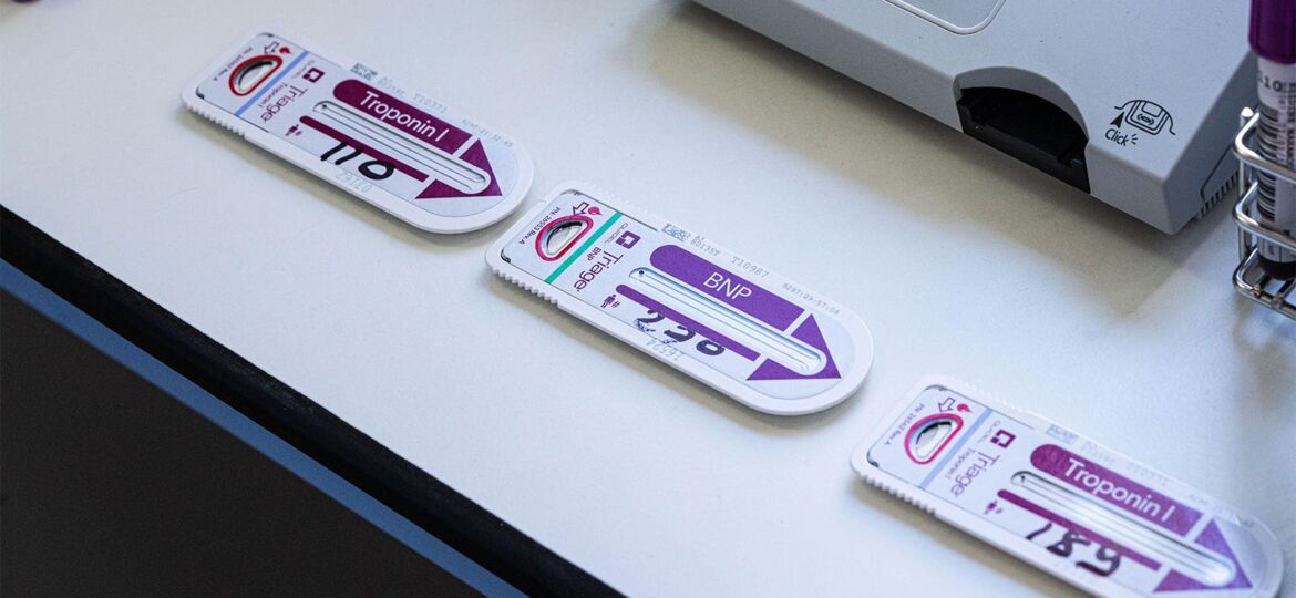 High-Sensitivity Troponin Test May Overestimate Risk in PE