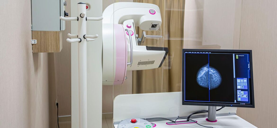 Annual Breast Cancer Screening Starting at Age 40 Best, Modeling Study Says