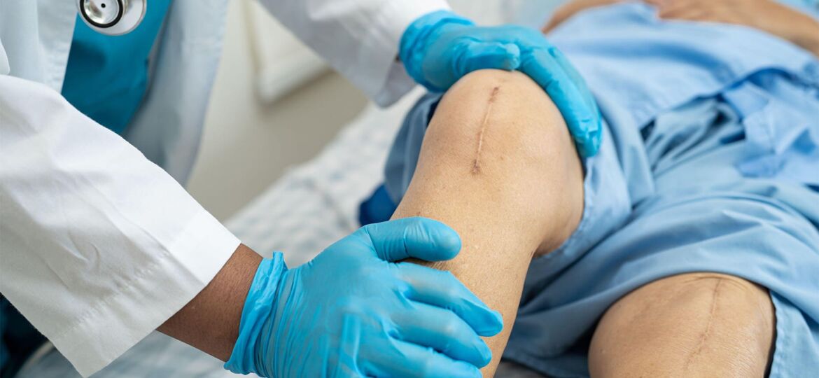 Multimodal Pre-Op Program Aids Knee Replacement Candidates