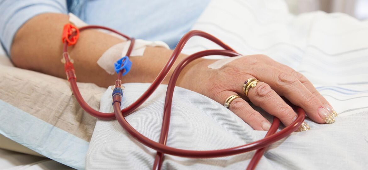 Multidisciplinary Team Intervention Flops for Improving CKD Outcomes