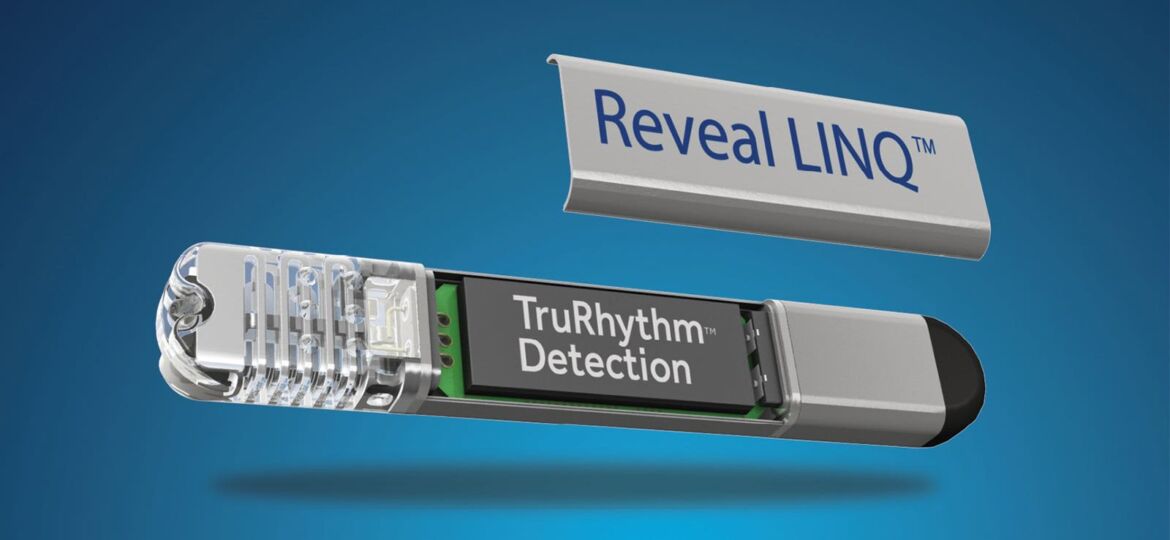 Clues for Smarter Rhythm Monitoring After Cardiac Surgery?