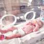 Skin-to-skin contact improves breastfeeding but not cognitive outcomes in very preterm infants: Clinical trial