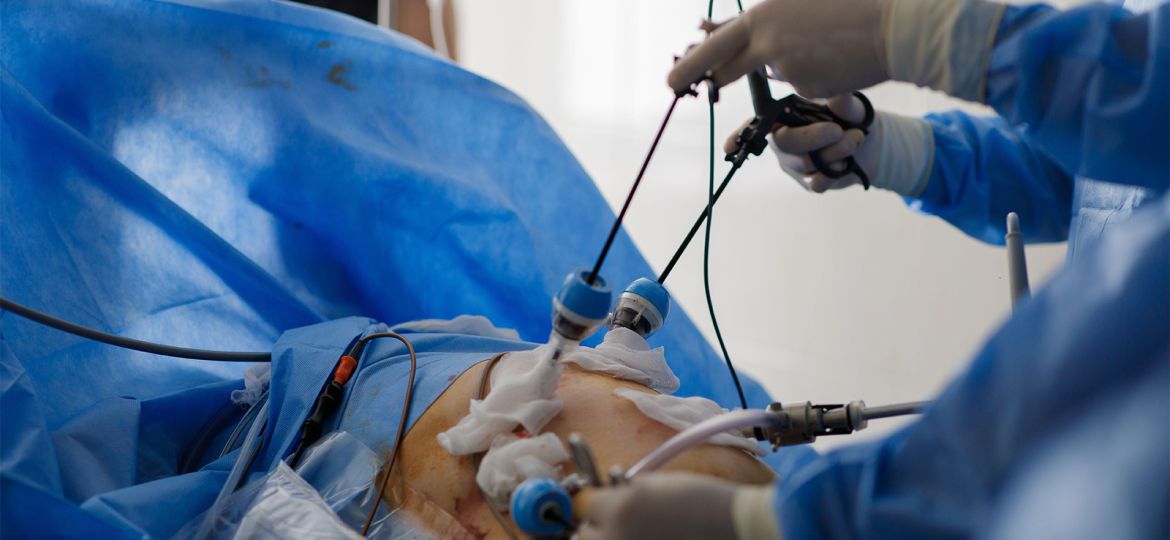 One Bariatric Surgery Procedure Better for the Heart?