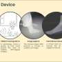 At-home ‘foot-recognition’ AI scanner can prevent heart failure hospitalizations