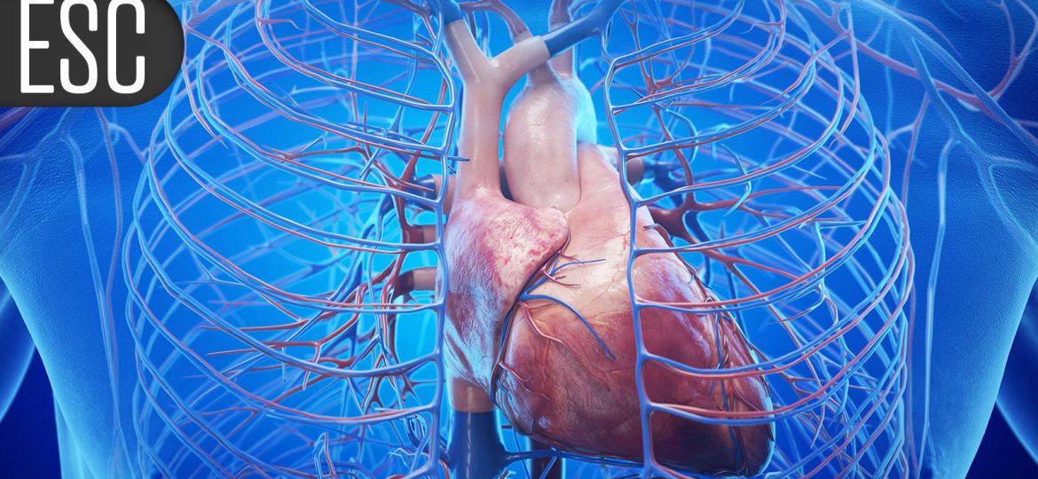 SWEDEPAD Trials Resurrect the Paclitaxel Death Signal in PAD Interventions