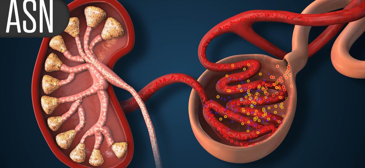 Culturally Tailored Approach Helps Latinos in Kidney Failure