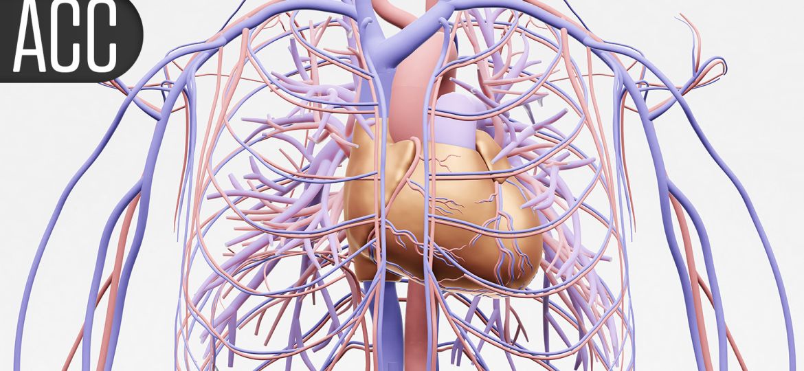 Impella Flops for Acute Coronary Syndrome Patients Not in Shock