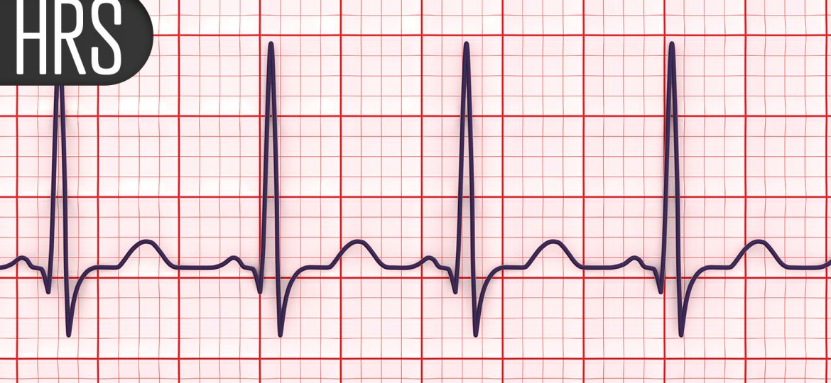 Think Heart Attacks Cause Most Sudden Cardiac Deaths? Think Again, Study Says