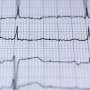 AI-powered electrocardiogram detects early signs of heart failure