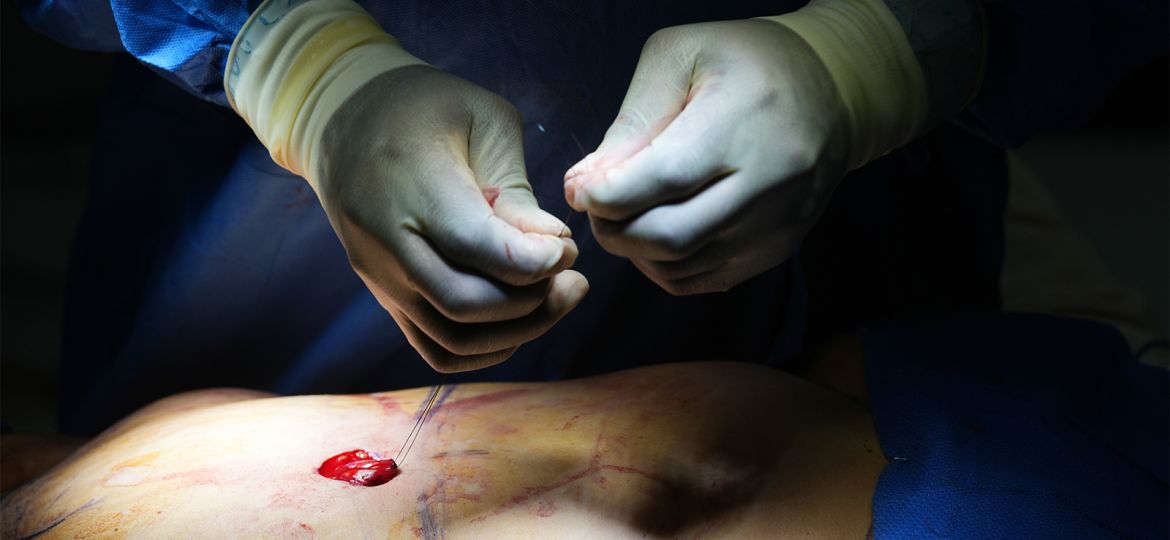 Cosmetic Interventions Are Booming. Many Say Ethical Conversations Are Lagging.
