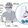 Using vagus nerve stimulation to improve treatment for movement rehabilitation
