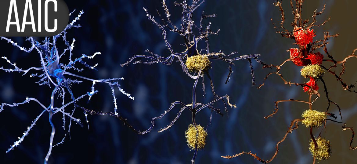 Lifestyle Changes May Slow Brain Aging in Adults Younger Than 70