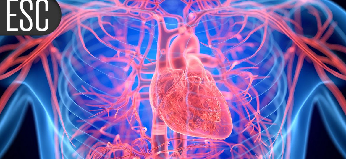 Afib Ablation Falls in New Sham-Controlled Trial